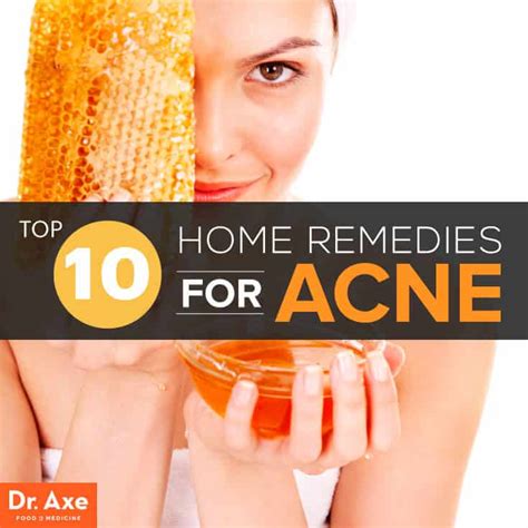 Natural Ways to Cure Acne